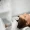 best Mesotherapy Hair treatment in Rawalpindi