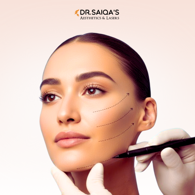 What Is a Thread Lift Your Guide to This Non-Surgical Facelift